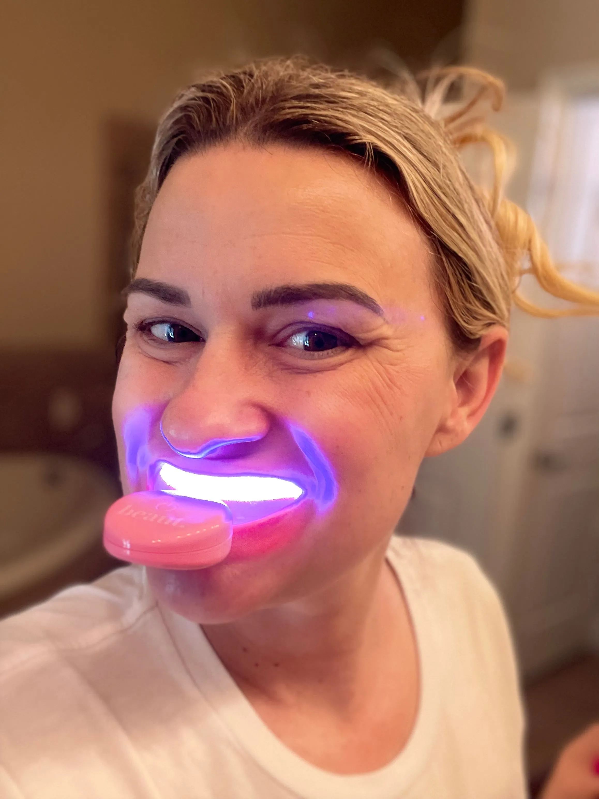 Beaut Wireless Dual-Light Therapy Teeth Whitening System