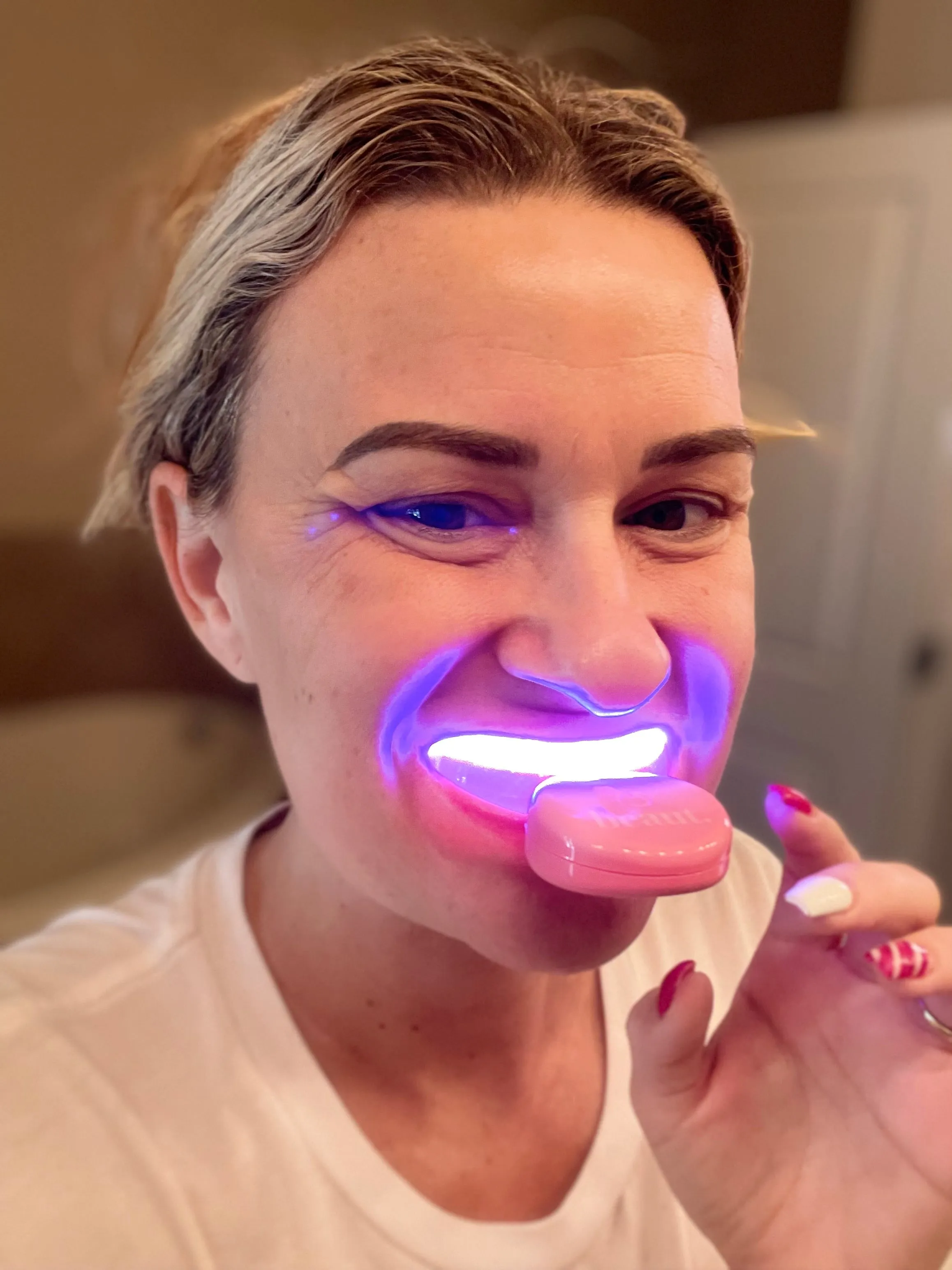 Beaut Wireless Dual-Light Therapy Teeth Whitening System
